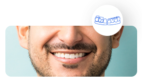 Smile-Makeover https://globaltest.web.boundlesstechnologies.net/wp-content/uploads/2025/09/Smile-Makeover.png