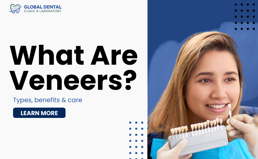 Veneers: What They Are & How They Improve Your Smile